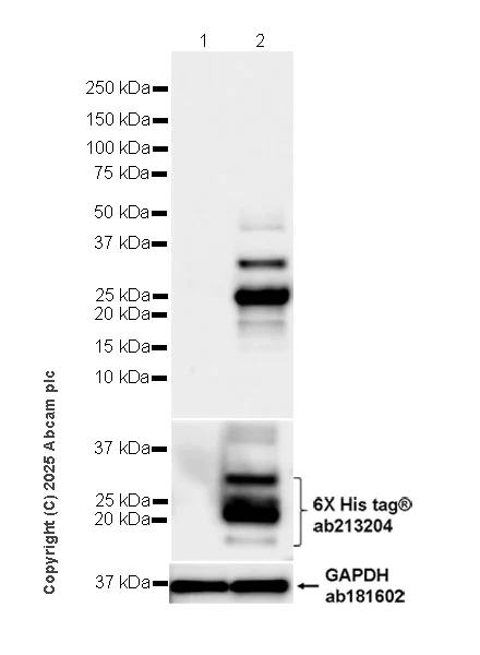 Western blot - Anti-Hepatitis B Virus Core Antigen antibody [EPR29890-38] (AB323646)
