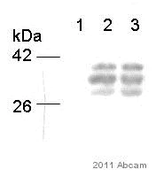 Western blot - Anti-Hepatitis B Virus pre S2 Antigen antibody [S26] (AB8635)