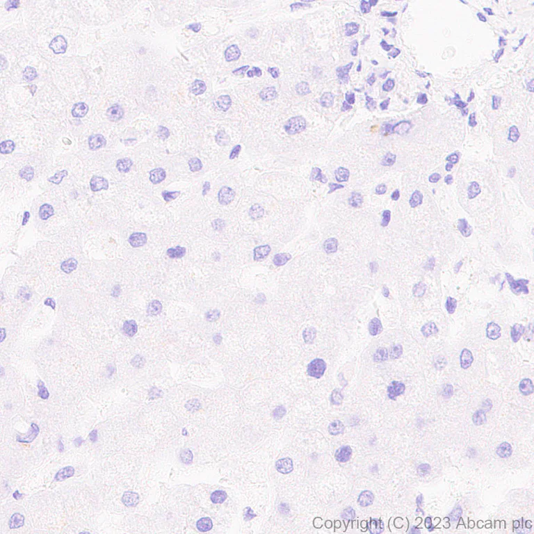 Immunohistochemistry (Formalin/PFA-fixed paraffin-embedded sections) - Anti-Hepatitis B virus Protein X antibody [EPR27041-49] (AB309352)