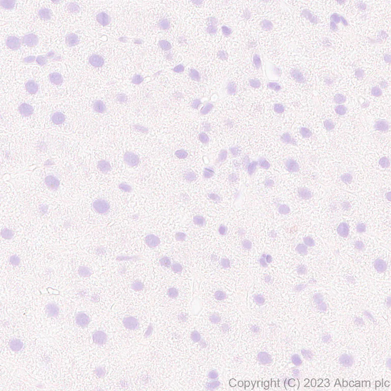 Immunohistochemistry (Formalin/PFA-fixed paraffin-embedded sections) - Anti-Hepatitis B virus Protein X antibody [EPR27041-49] (AB309352)