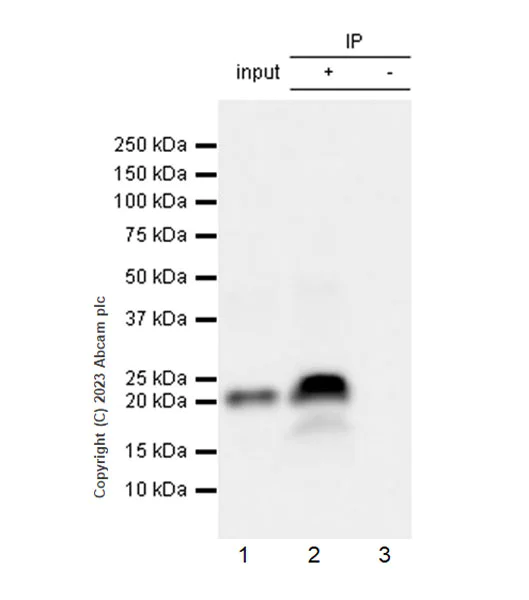 Immunoprecipitation - Anti-Hepatitis B virus Protein X antibody [EPR27041-49] (AB309352)