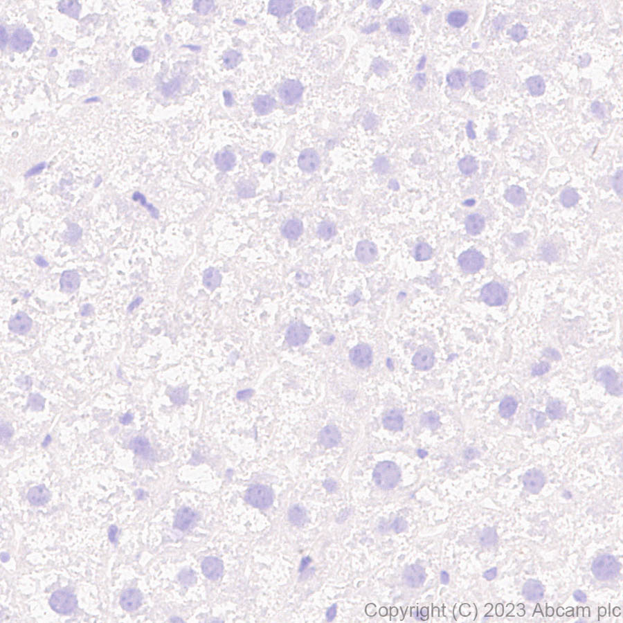 Immunohistochemistry (Formalin/PFA-fixed paraffin-embedded sections) - Anti-Hepatitis B virus Protein X antibody [EPR27041-49] - BSA and Azide free (AB309353), expandable thumbnail