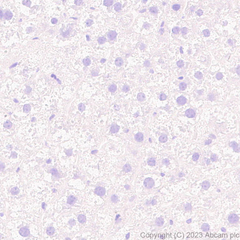 Immunohistochemistry (Formalin/PFA-fixed paraffin-embedded sections) - Anti-Hepatitis B virus Protein X antibody [EPR27041-49] - BSA and Azide free (AB309353)