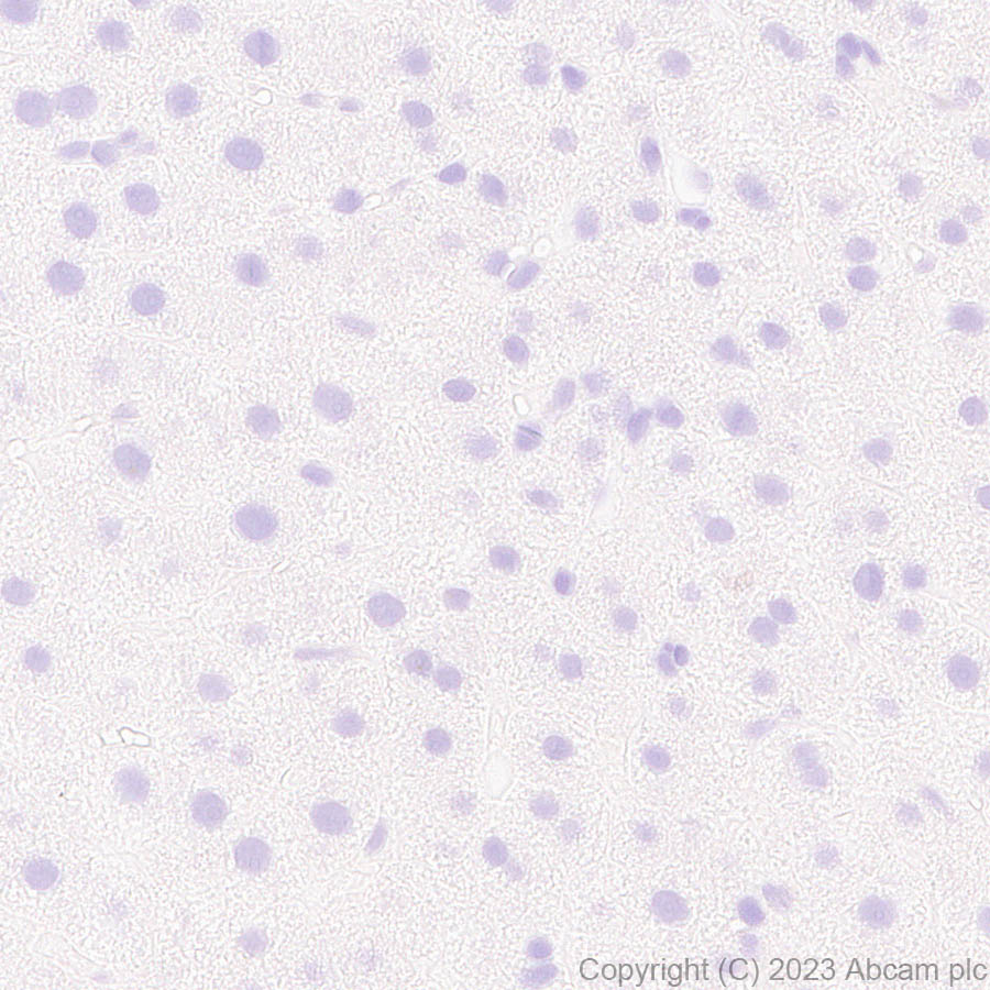 Immunohistochemistry (Formalin/PFA-fixed paraffin-embedded sections) - Anti-Hepatitis B virus Protein X antibody [EPR27041-49] - BSA and Azide free (AB309353), expandable thumbnail