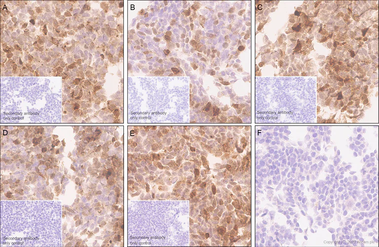 Immunohistochemistry (Formalin/PFA-fixed paraffin-embedded sections) - Anti-Hepatitis B virus Protein X antibody [EPR27041-49] - BSA and Azide free (AB309353)