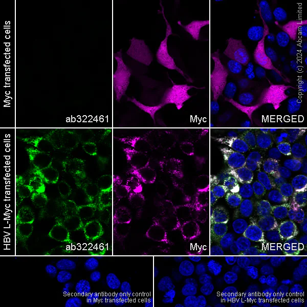 Immunocytochemistry/ Immunofluorescence - Anti-Hepatitis B Virus Surface Antigen antibody [EPR29887-532] (AB322461)