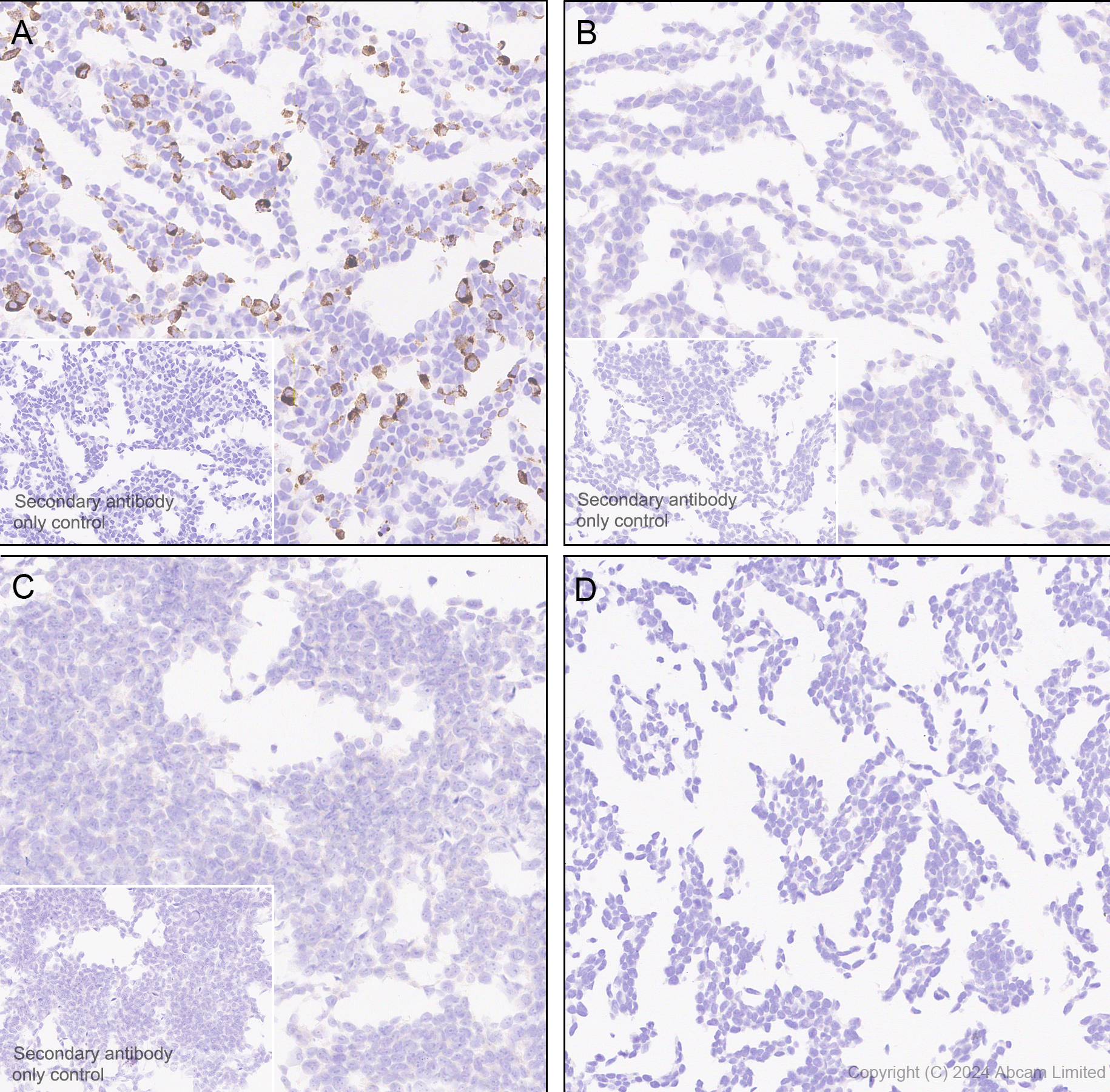 Immunohistochemistry (Formalin/PFA-fixed paraffin-embedded sections) - Anti-Hepatitis B Virus Surface Antigen antibody [EPR29887-532] (AB322461), expandable thumbnail