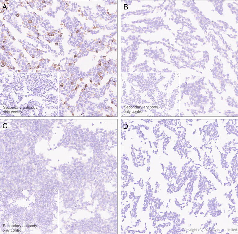 Immunohistochemistry (Formalin/PFA-fixed paraffin-embedded sections) - Anti-Hepatitis B Virus Surface Antigen antibody [EPR29887-532] (AB322461)