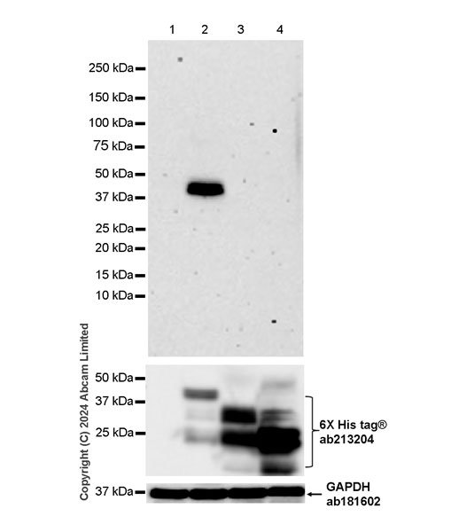 Western blot - Anti-Hepatitis B Virus Surface Antigen antibody [EPR29887-532] (AB322461), expandable thumbnail