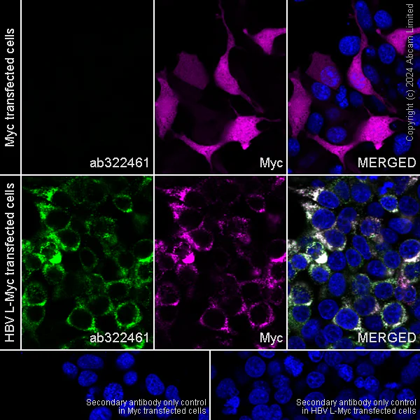 Immunocytochemistry/ Immunofluorescence - Anti-Hepatitis B Virus Surface Antigen antibody [EPR29887-532] - BSA and Azide free (AB326587)