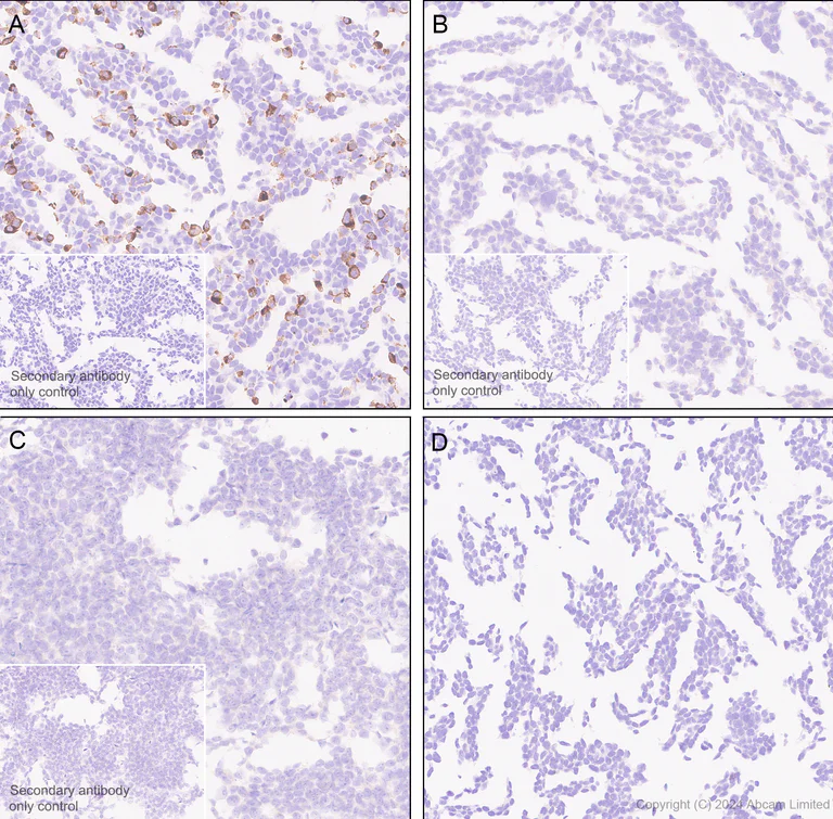 Immunohistochemistry (Formalin/PFA-fixed paraffin-embedded sections) - Anti-Hepatitis B Virus Surface Antigen antibody [EPR29887-532] - BSA and Azide free (AB326587)