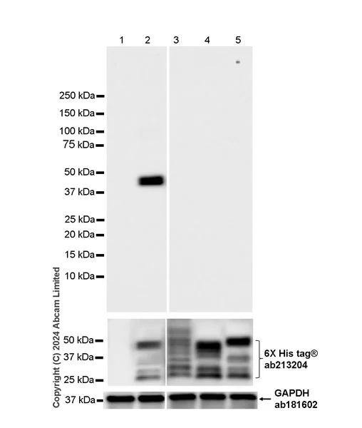 Western blot - Anti-Hepatitis B Virus Surface Antigen antibody [EPR29887-532] - BSA and Azide free (AB326587)