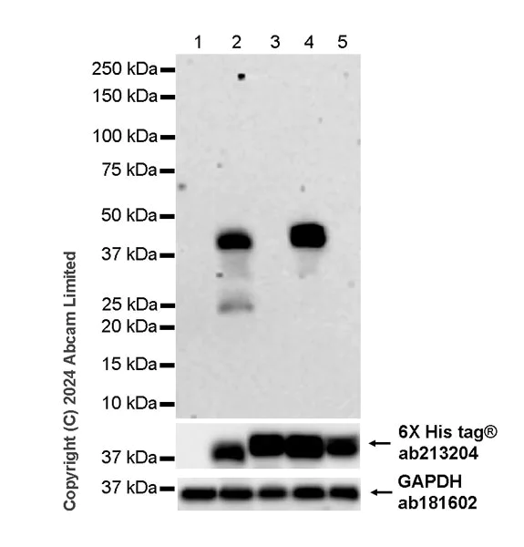 Western blot - Anti-Hepatitis B Virus Surface Antigen (ayw and ayr) antibody [2D11] - BSA and Azide free (AB319999)
