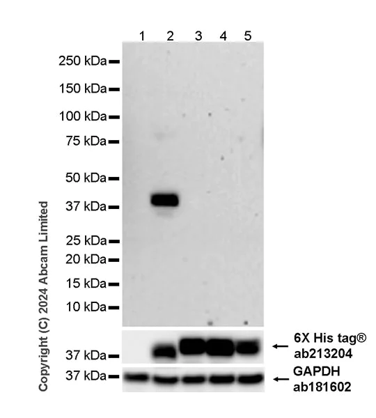 Western blot - Anti-Hepatitis B Virus Surface Antigen (ayw) antibody [1C10] - BSA and Azide free (AB324813)