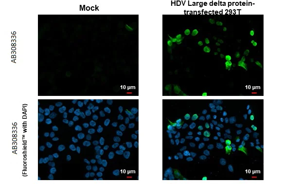 Immunocytochemistry/ Immunofluorescence - Anti-Hepatitis D virus Large delta protein antibody [HL1051] (AB308336)