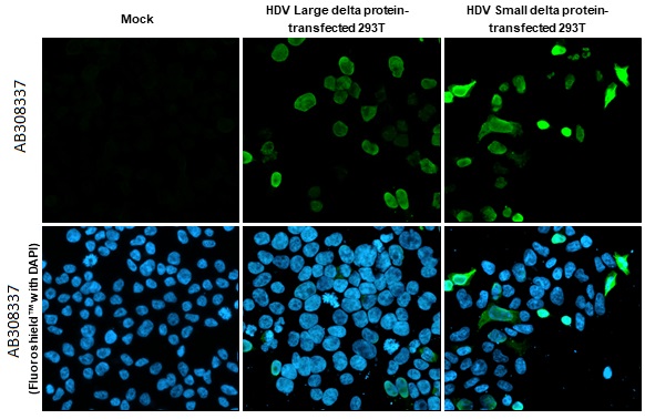 Immunocytochemistry/ Immunofluorescence - Anti-Hepatitis D virus Large delta + Small delta protein antibody [HL1053] (AB308337), expandable thumbnail