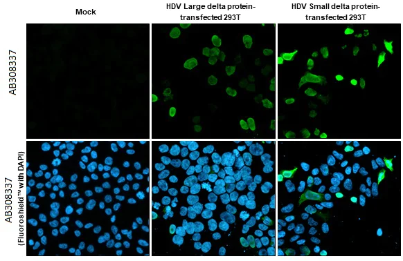 Immunocytochemistry/ Immunofluorescence - Anti-Hepatitis D virus Large delta + Small delta protein antibody [HL1053] (AB308337)