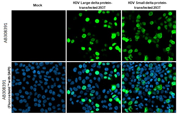 Immunocytochemistry/ Immunofluorescence - Anti-Hepatitis D virus Large delta + Small delta protein antibody [HL1055] (AB308391), expandable thumbnail