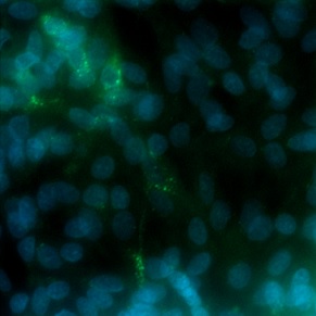 Immunocytochemistry/ Immunofluorescence - Anti-Hepatitis E Virus antibody [5F3] (AB233244), expandable thumbnail