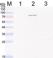 Western blot - Anti-Hepatitis E Virus antibody [5F3] (AB233244), expandable thumbnail