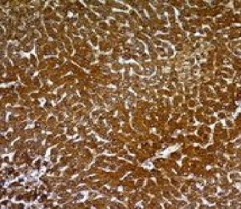 Immunohistochemistry (Formalin/PFA-fixed paraffin-embedded sections) - Anti-Hepatocyte Specific Antigen antibody [OCH1E5] - BSA and Azide free (AB234028)
