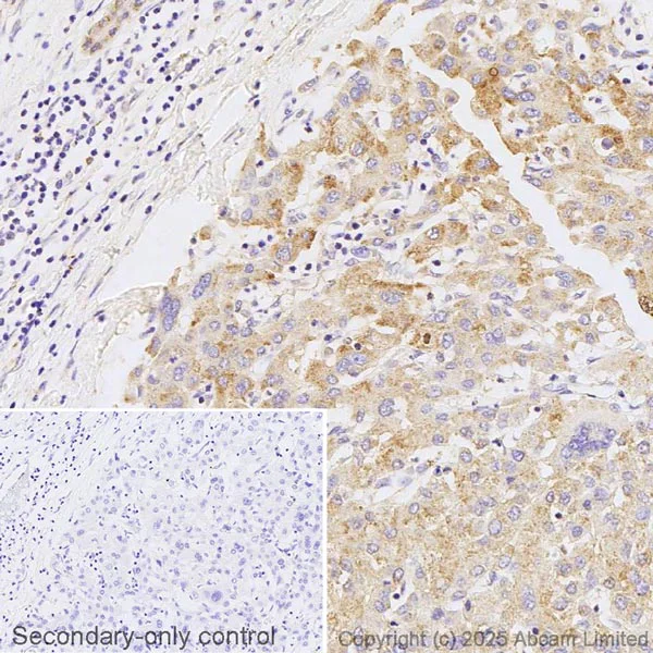 Immunohistochemistry (Formalin/PFA-fixed paraffin-embedded sections) - Anti-Hepcidin-25 antibody (AB30760)