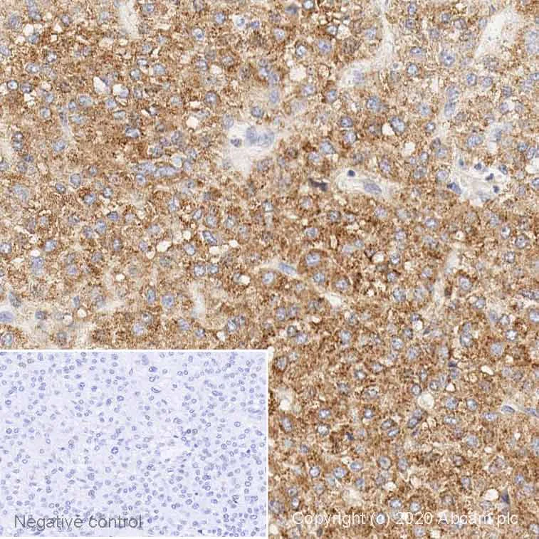 Immunohistochemistry (Formalin/PFA-fixed paraffin-embedded sections) - Anti-Hepcidin-25 antibody (AB30760)