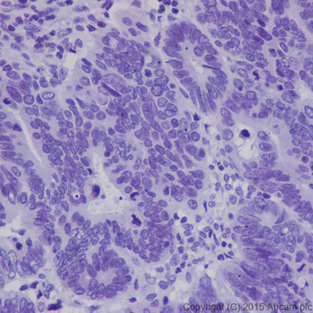 Immunohistochemistry (Formalin/PFA-fixed paraffin-embedded sections) - Anti-Hepcidin + Hepcidin-2 antibody [EPR18937] (AB190775)