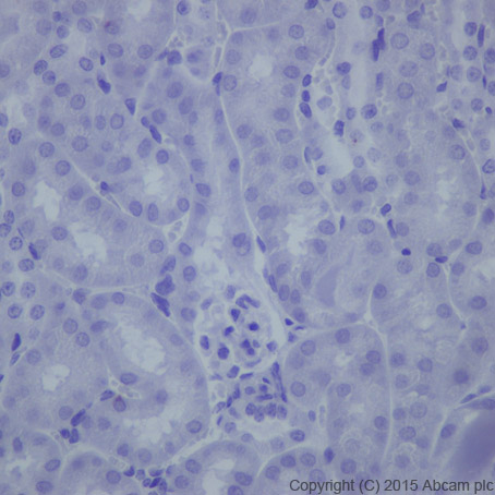 Immunohistochemistry (Formalin/PFA-fixed paraffin-embedded sections) - Anti-Hepcidin + Hepcidin-2 antibody [EPR18937] (AB190775), expandable thumbnail