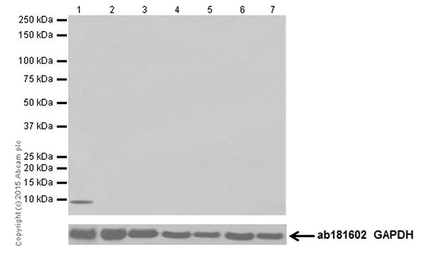 Western blot - Anti-Hepcidin + Hepcidin-2 antibody [EPR18937] (AB190775), expandable thumbnail