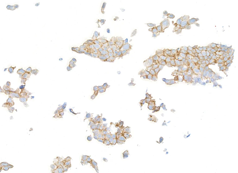Immunocytochemistry - Anti-HER2/ErbB2 antibody [BLR241L] - BSA free (AB314070)