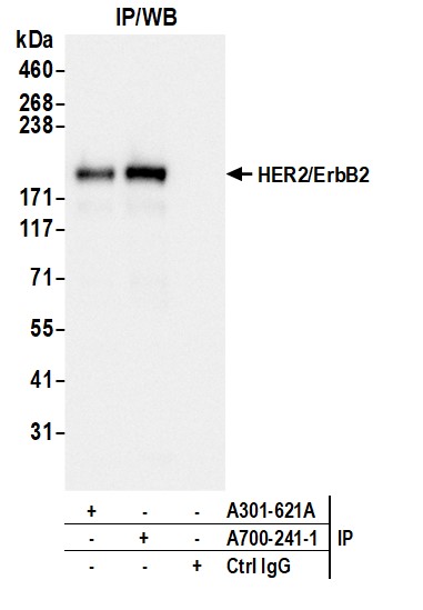 Immunoprecipitation - Anti-HER2/ErbB2 antibody [BLR241L] - BSA free (ab314070), expandable thumbnail