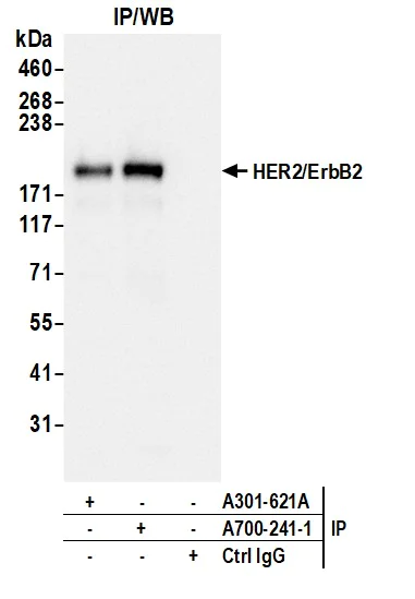 Immunoprecipitation - Anti-HER2/ErbB2 antibody [BLR241L] - BSA free (AB314070)