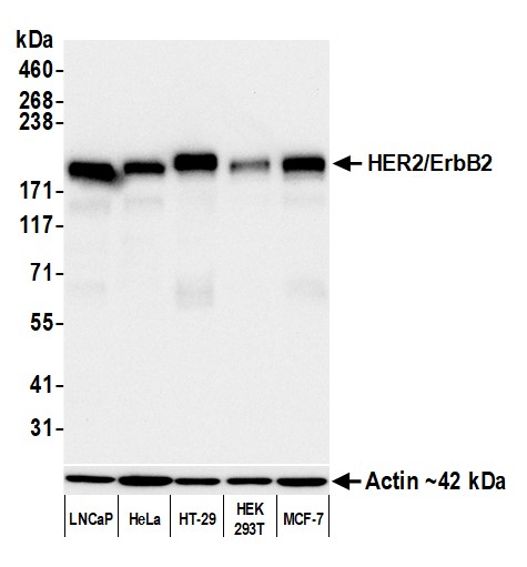 Western blot - Anti-HER2/ErbB2 antibody [BLR241L] - BSA free (AB314070), expandable thumbnail