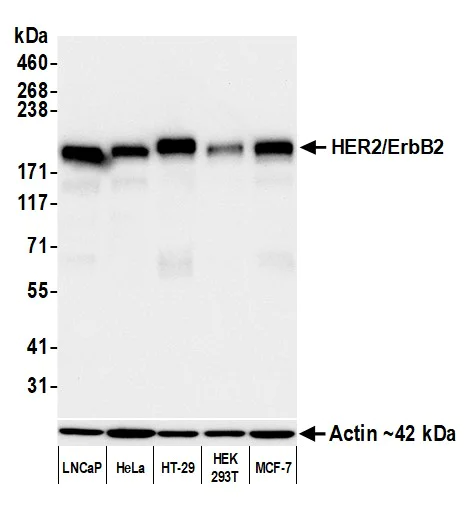 Western blot - Anti-HER2/ErbB2 antibody [BLR241L] - BSA free (AB314070)