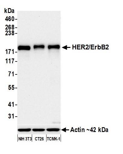 Western blot - Anti-HER2/ErbB2 antibody [BLR241L] - BSA free (AB314070), expandable thumbnail