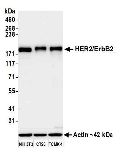 Western blot - Anti-HER2/ErbB2 antibody [BLR241L] - BSA free (AB314070)