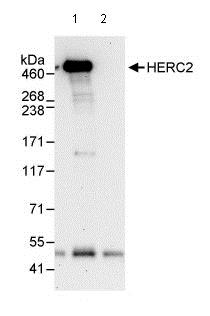 Immunoprecipitation - Anti-HERC2 antibody (AB85832)