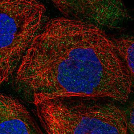 Immunocytochemistry/ Immunofluorescence - Anti-HERC4 antibody (AB221757)