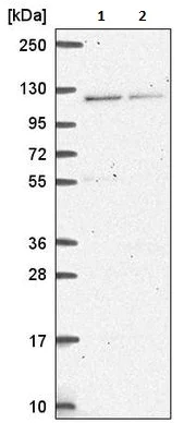 Western blot - Anti-HERC4 antibody (AB221757)