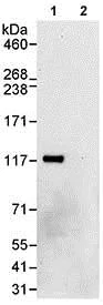 Immunoprecipitation - Anti-HERC4 antibody (AB85732)