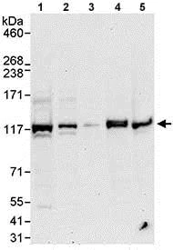 Western blot - Anti-HERC4 antibody (AB85732)