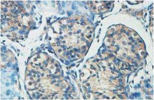 Immunohistochemistry (Formalin/PFA-fixed paraffin-embedded sections) - Anti-HERC6 antibody (AB99949)