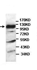 Western blot - Anti-HERC6 antibody (AB99949)