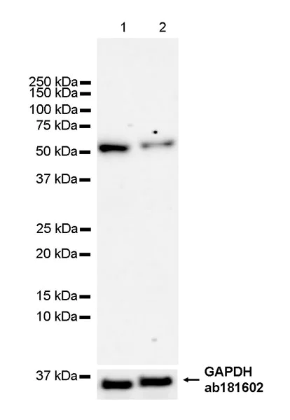 Western blot - Anti-HERV antibody [EPR29291-23] (AB324913)
