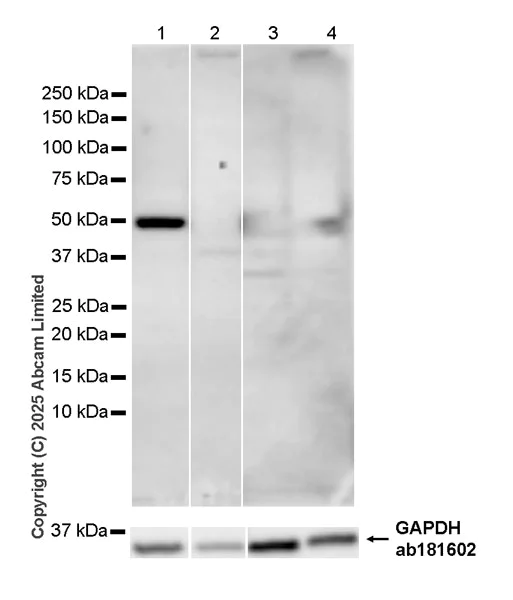 Western blot - Anti-HERV antibody [EPR29291-23] (AB324913)