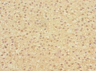 Immunohistochemistry (Formalin/PFA-fixed paraffin-embedded sections) - Anti-HERV-FRD antibody (AB230198), expandable thumbnail
