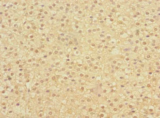 Immunohistochemistry (Formalin/PFA-fixed paraffin-embedded sections) - Anti-HERV-FRD antibody (AB230198)