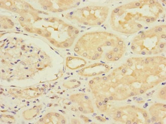 Immunohistochemistry (Formalin/PFA-fixed paraffin-embedded sections) - Anti-HERV-FRD antibody (AB230198), expandable thumbnail