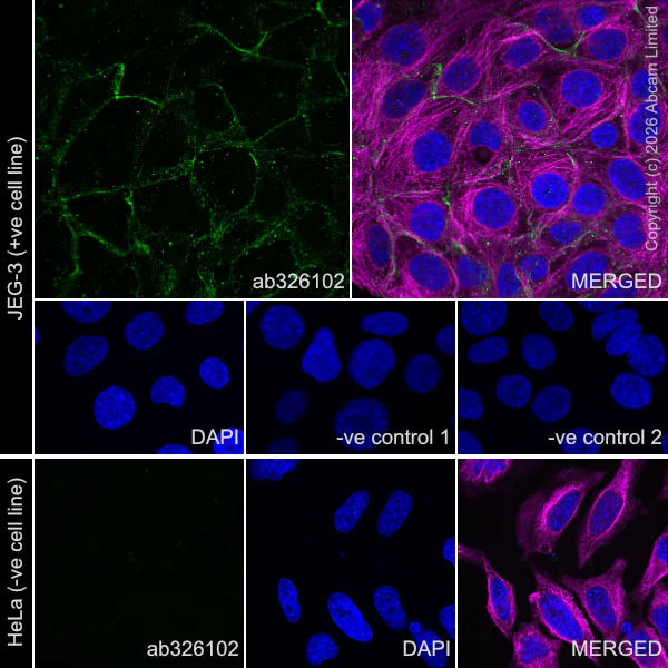 Immunocytochemistry/ Immunofluorescence - Anti-HERV-FRD antibody [EPR30312-632] (AB326102)